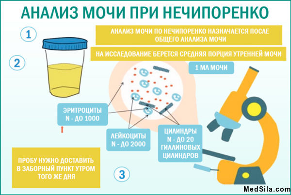 Микроскопия мочи